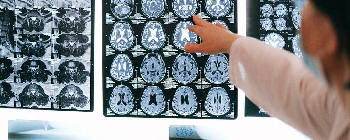 découvrez les avantages de la décompression neurologique, une approche innovante pour soulager la douleur et améliorer le bien-être. explorez les techniques, les bénéfices et les témoignages de ceux qui ont retrouvé une qualité de vie optimale grâce à cette méthode.