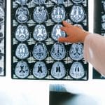 découvrez les avantages de la décompression neurologique, une approche innovante pour soulager la douleur et améliorer le bien-être. explorez les techniques, les bénéfices et les témoignages de ceux qui ont retrouvé une qualité de vie optimale grâce à cette méthode.