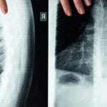 découvrez la décompression spinale, une thérapie innovante pour soulager les douleurs du dos et améliorer la santé du système musculo-squelettique. retrouvez votre bien-être et redécouvrez la liberté de mouvement grâce à des traitements adaptés.