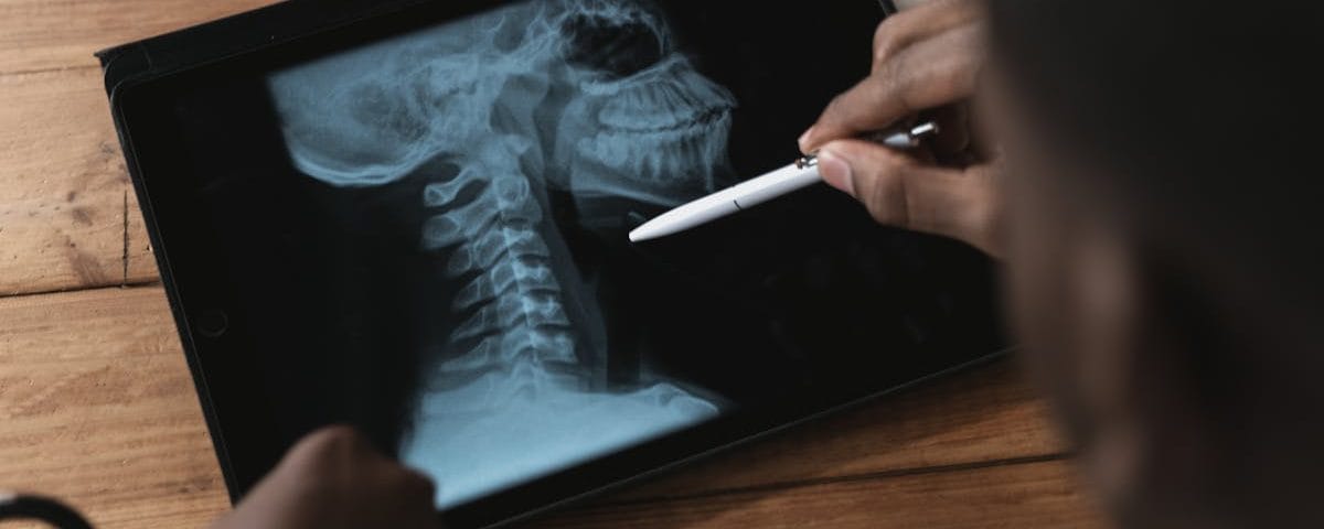 découvrez les bienfaits de la décompression spinal : une méthode efficace pour soulager les douleurs dorsales, améliorer la mobilité et favoriser un bien-être optimal. apprenez comment cette approche thérapeutique peut transformer votre qualité de vie.