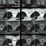 découvrez la décompression spinale, une technique innovante conçue pour soulager les douleurs dorsales et améliorer la santé de la colonne vertébrale. en savoir plus sur ses bienfaits et comment elle peut vous aider à retrouver une meilleure qualité de vie.