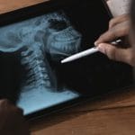 découvrez la décompression spinale, une méthode non chirurgicale visant à soulager les douleurs dorsales et à améliorer la posture. apprenez comment cette technique peut vous aider à retrouver confort et mobilité, tout en favorisant la santé de votre colonne vertébrale.