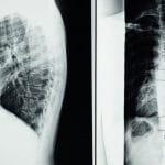 découvrez les bienfaits de la décompression spinale, une approche innovante pour soulager les douleurs lombaires et cervicales. améliorez votre qualité de vie grâce à cette technique non invasive qui favorise la régénération des disques intervertébraux et le bien-être global.