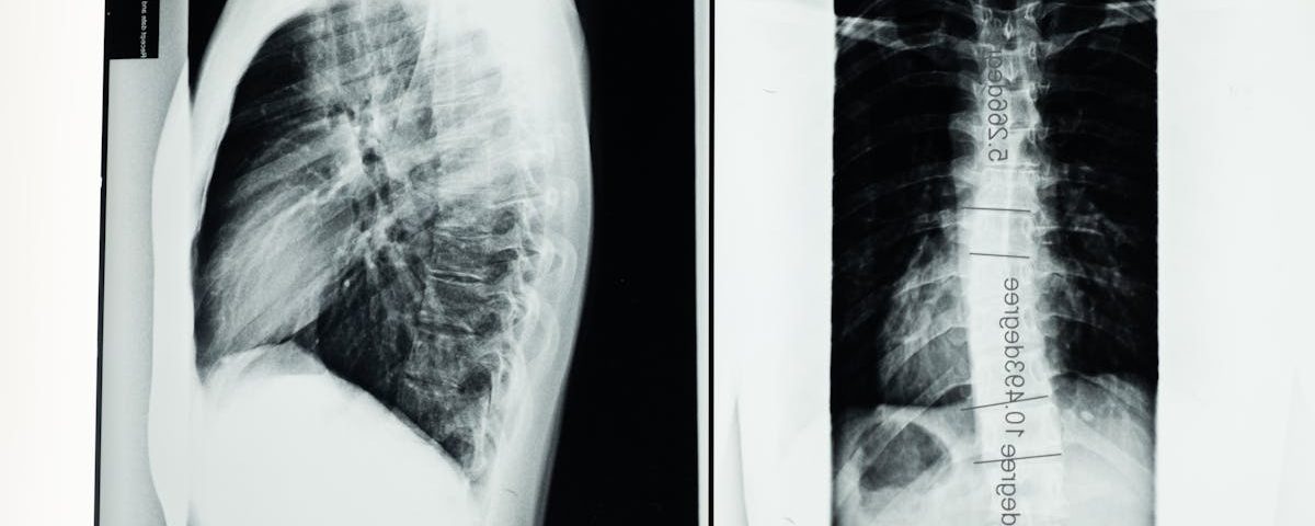 découvrez la décompression spinale, une méthode thérapeutique innovante pour soulager les douleurs dorsales et améliorer la santé de la colonne vertébrale. apprenez-en plus sur ses avantages, ses techniques et comment elle peut transformer votre bien-être.