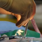 découvrez tout ce qu'il faut savoir sur la sténose foraminale, une condition qui peut provoquer des douleurs et des engourdissements. apprenez les symptômes, les causes et les options de traitement pour améliorer votre qualité de vie.