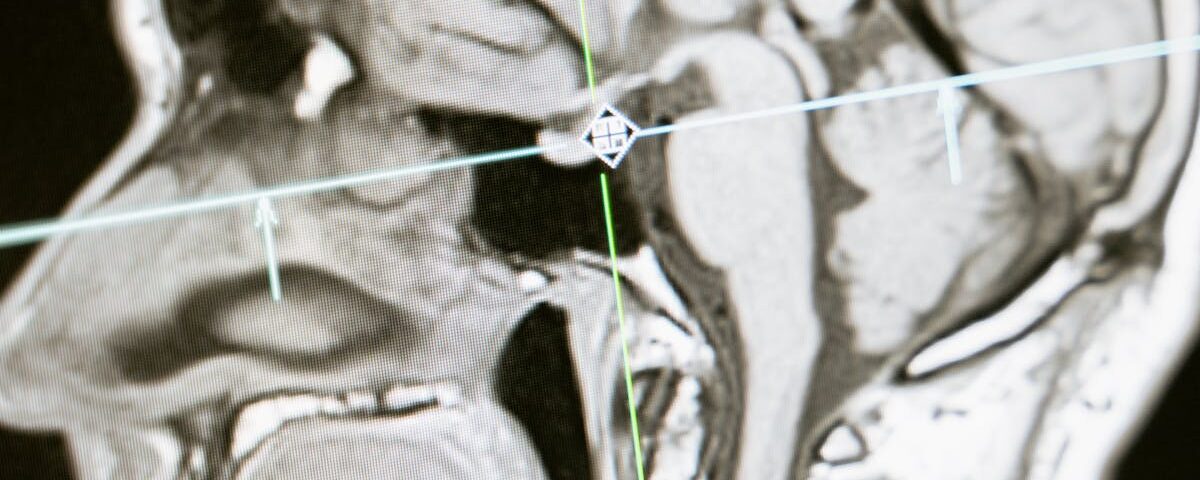 découvrez les dernières avancées et innovations en matière de recherche médicale. explorez des études, des découvertes scientifiques et des traitements émergents qui transforment le domaine de la santé et améliorent la qualité de vie.