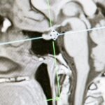 découvrez les dernières avancées et innovations en matière de recherche médicale. explorez des études, des découvertes scientifiques et des traitements émergents qui transforment le domaine de la santé et améliorent la qualité de vie.