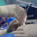 découvrez ce qu'est la sténose foraminale, ses causes, symptômes et options de traitement. apprenez à mieux comprendre cette condition liée à la colonne vertébrale et comment elle peut affecter votre qualité de vie.