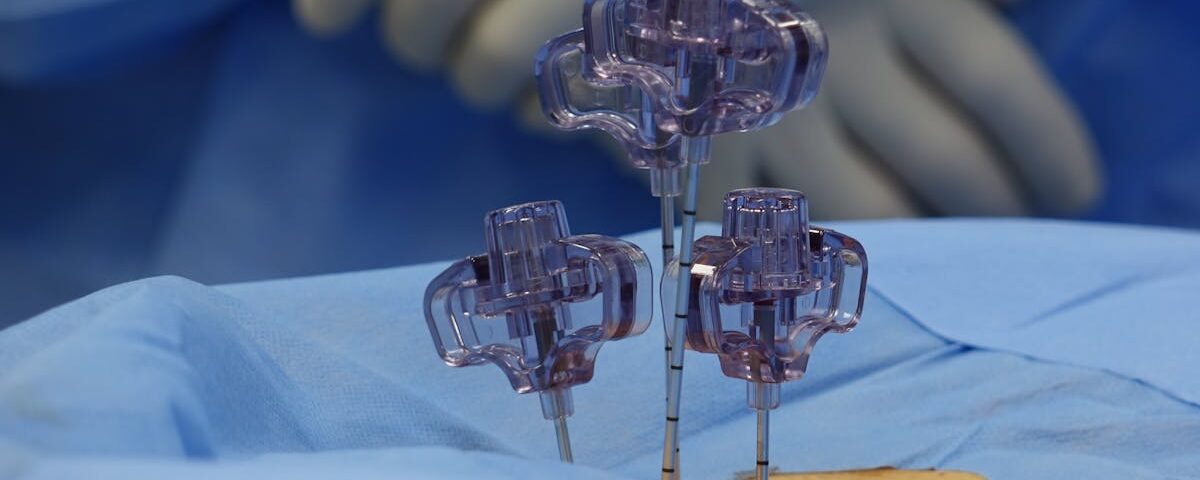 découvrez tout ce que vous devez savoir sur la sténose foraminale : causes, symptômes, diagnostics et options de traitement. apprenez comment cette condition peut affecter votre santé et les meilleures pratiques pour soulager la douleur et améliorer votre qualité de vie.