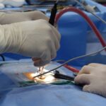 découvrez les symptômes, les causes et les traitements de la sténose spinale, une affection qui provoque un rétrécissement du canal spinal. informez-vous sur les options de gestion de la douleur et les recommandations médicales pour retrouver votre qualité de vie.