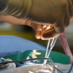 découvrez tout ce qu'il faut savoir sur la sténose foraminale, une condition qui affecte les nerfs et peut provoquer des douleurs ou des engourdissements. apprenez les causes, les symptômes, et les options de traitement disponibles pour améliorer votre qualité de vie.