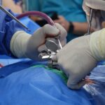 découvrez les avantages de la décompression spinale, une technique thérapeutique efficace pour soulager les douleurs dorsales et améliorer la mobilité. idéale pour ceux souffrant de hernies discales, sciatique ou tensions musculaires, la décompression spinale offre une approche naturelle et non invasive pour retrouver le bien-être.