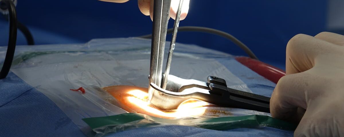 découvrez tout ce que vous devez savoir sur la sténose spinale, y compris ses symptômes, causes, diagnostics et options de traitement. informez-vous sur les méthodes pour soulager la douleur et améliorer votre qualité de vie.