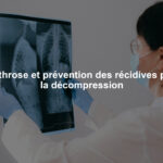 Arthrose et prévention des récidives par la décompression
