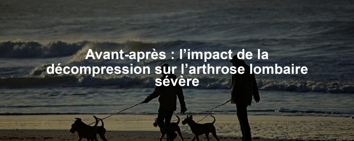 Avant-après : l’impact de la décompression sur l’arthrose lombaire sévère