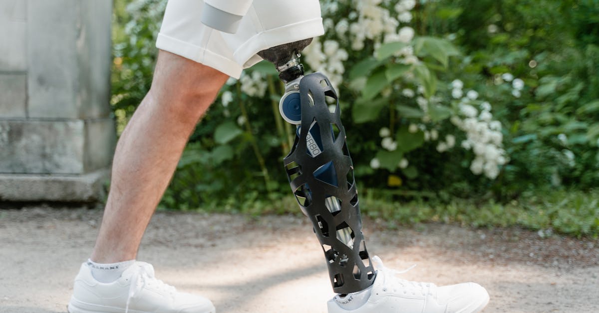 découvrez des conseils et traitements efficaces pour améliorer la mobilité et récupérer après une arthrose cervicale.