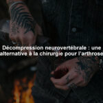 Décompression neurovertébrale : une alternative à la chirurgie pour l’arthrose