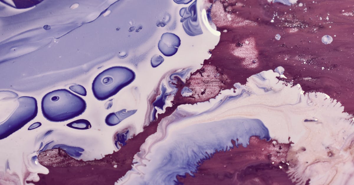 découvrez tout sur l'ostéoarthrite : symptômes, causes, traitements et conseils pour mieux vivre avec cette maladie articulaire dégénérative.