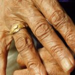 découvrez tout sur l'arthrite : symptômes, causes et traitements pour mieux gérer cette maladie inflammatoire des articulations.