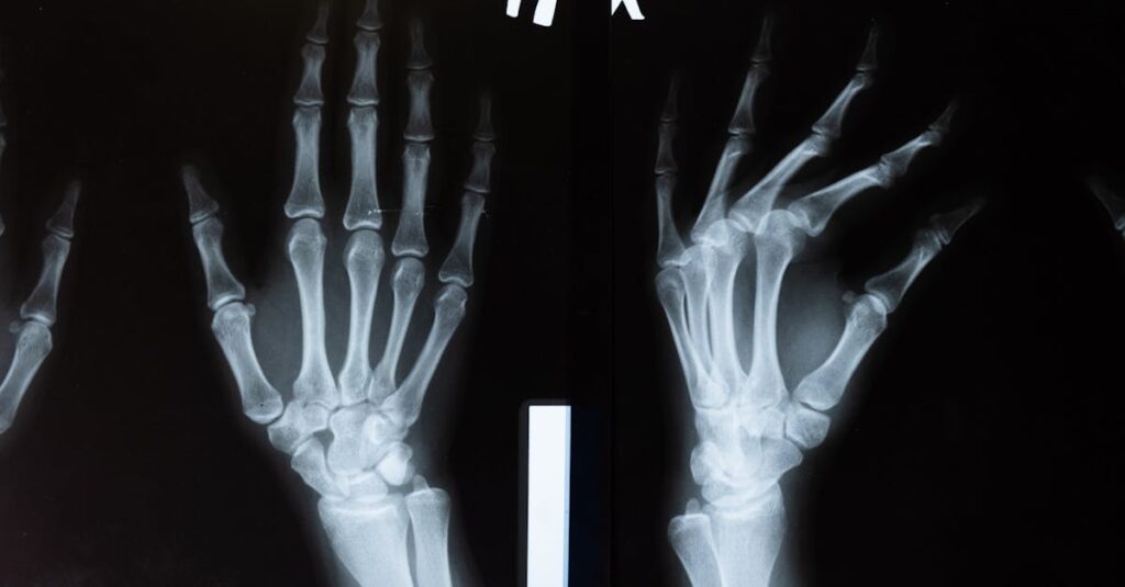 découvrez tout sur l'arthrose, ses causes, symptômes et traitements pour mieux gérer cette maladie articulaire chronique.