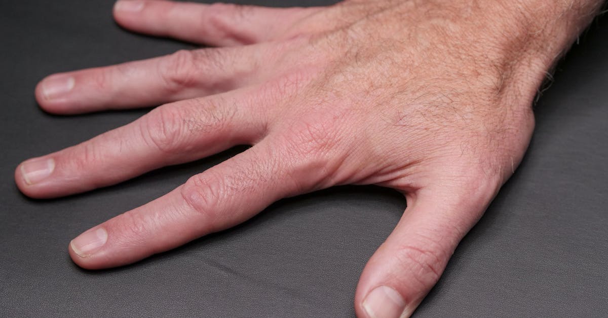 découvrez tout sur l'ostéoarthrite : symptômes, causes, traitements et conseils pour mieux gérer cette maladie articulaire courante.