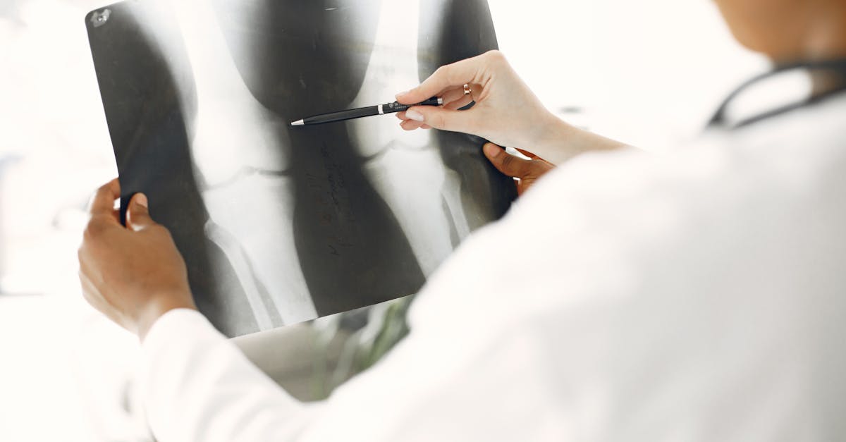 découvrez tout ce qu'il faut savoir sur l'ostéoarthrite, une maladie articulaire courante, ses symptômes, causes, traitements et conseils pour mieux gérer la douleur au quotidien.