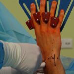 clinique spécialisée en décompression pour l'arthrose, offrant des traitements innovants pour soulager la douleur et améliorer la mobilité articulaire.
