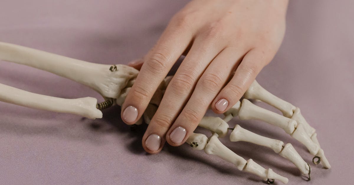 découvrez tout ce qu'il faut savoir sur l'arthrose, ses causes, symptômes et traitements pour mieux gérer cette maladie articulaire courante.