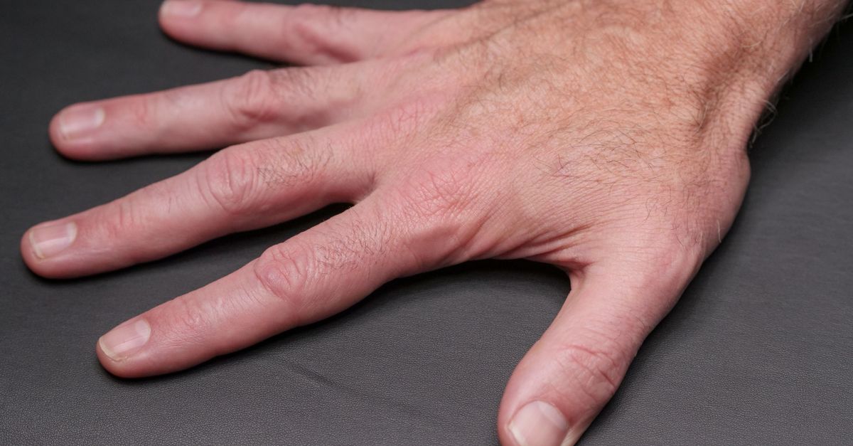 découvrez tout ce qu'il faut savoir sur l'ostéoarthrite : symptômes, causes, traitements et conseils pour mieux vivre avec cette maladie articulaire chronique.