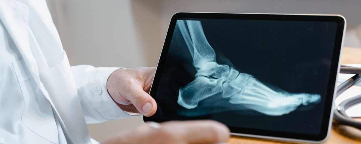 découvrez tout sur l'arthrose : symptômes, causes, traitements et conseils pour mieux gérer cette maladie articulaire chronique.
