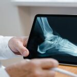 découvrez tout sur l'arthrose : symptômes, causes, traitements et conseils pour mieux gérer cette maladie articulaire chronique.